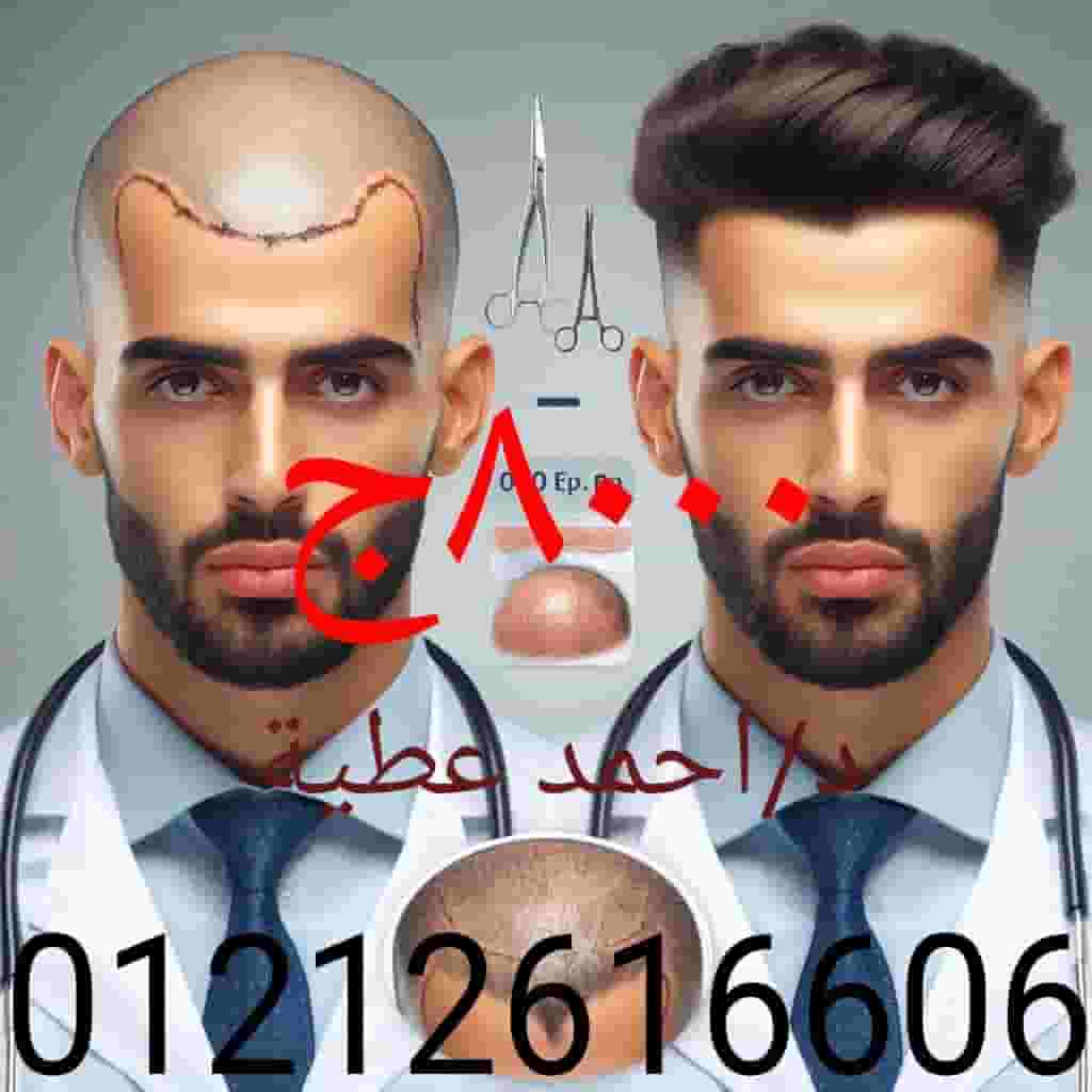 Dr. Ahmed Attia is a consultant of surgery, plastic surgery and hair transplantation