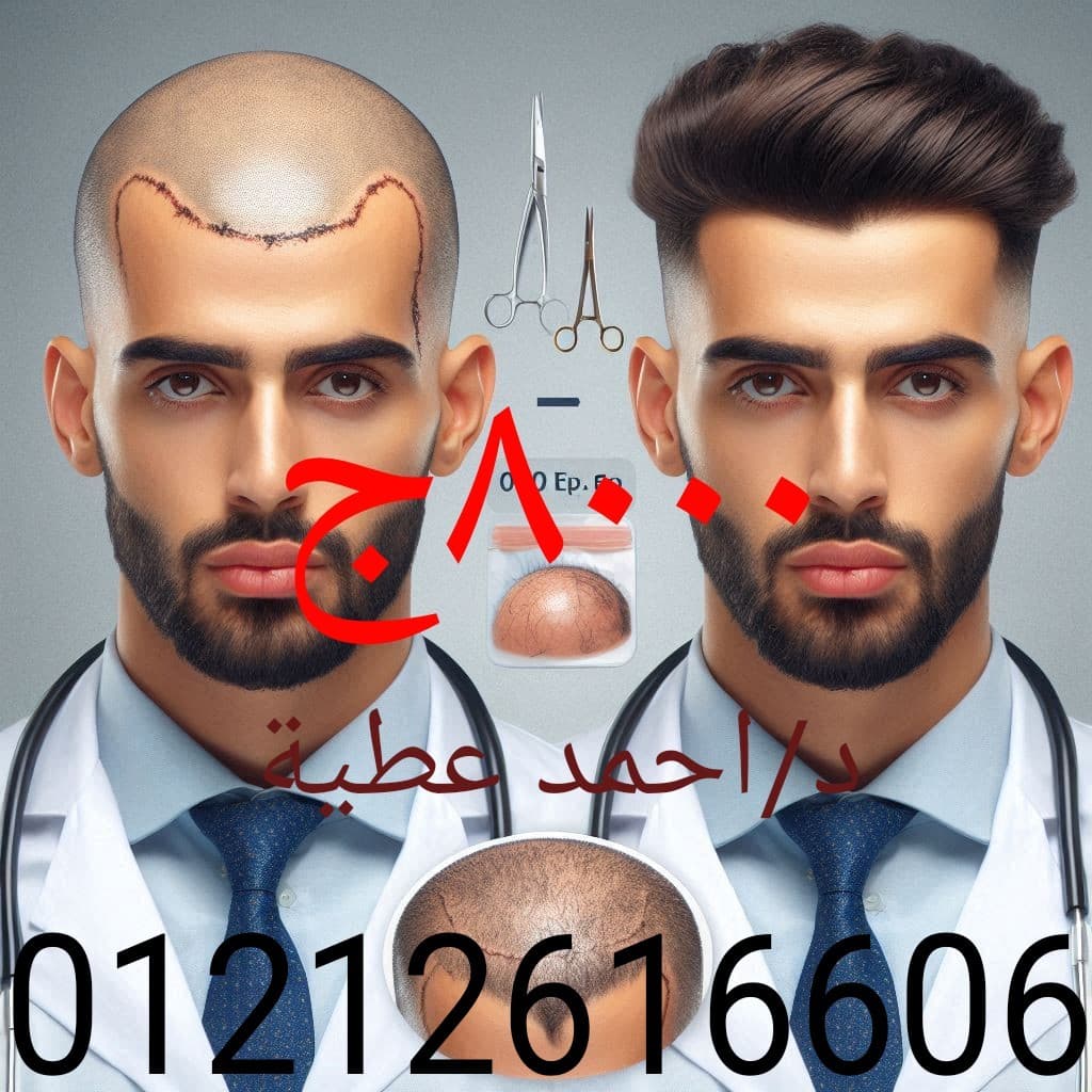Dr. Ahmed Attia is a consultant of surgery, plastic surgery and hair transplantation 0